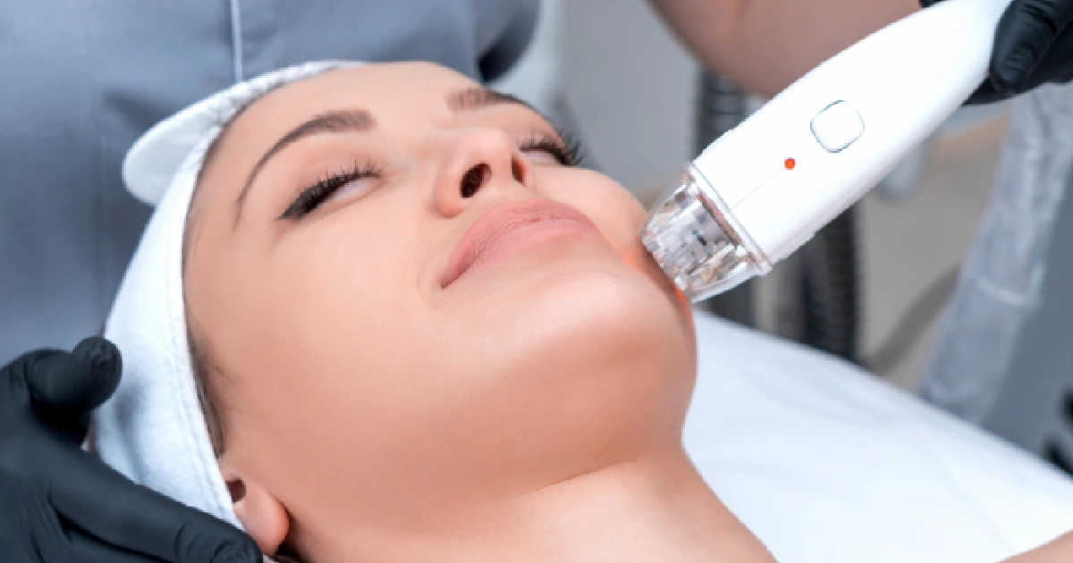 A woman undergoing an Alma Hybrid™ laser skin treatment in Tucson, AZ
