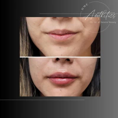 Case 2501 View Angle Front