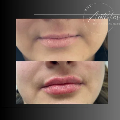 Case 2504 View Angle Front