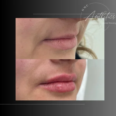 Case 2504 View Angle Left Angle Obligue