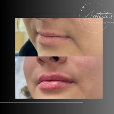 Case 2504 View Angle Right Angle Oblique